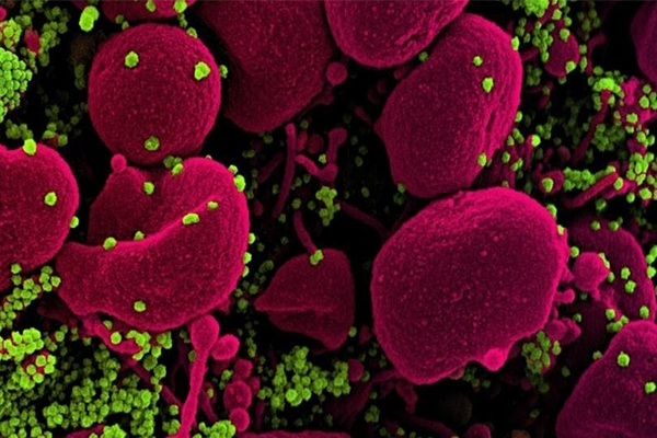 Existing Drug That Inhibits COVID-19 Virus Identified Existing Drug That Inhibits COVID-19 Virus Identified